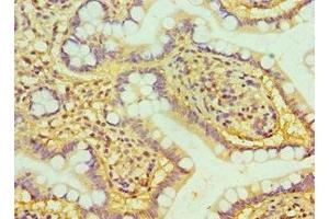 Immunohistochemistry of paraffin-embedded human small intestine tissue using ABIN7162382 at dilution of 1:100