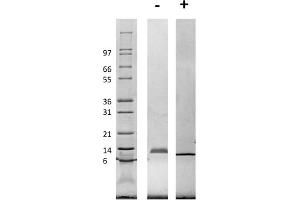 SDS-PAGE of Rat Macrophage Inflammatory Protein-1 alpha (CCL3) Recombinant Protein SDS-PAGE of Rat Macrophage Inflammatory Protein-1 alpha (CCL3) Recombinant Protein. (CCL3 Protein)