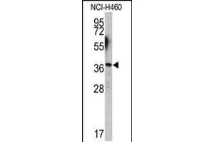 Western blot analysis of EN2 antibody (C-term-2) in NCI-H460 cell line lysates (35ug/lane) (EN2 Antikörper  (C-Term))