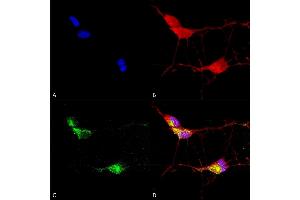 Immunocytochemistry/Immunofluorescence analysis using Mouse Anti-TrpV3 Monoclonal Antibody, Clone N15/4 (ABIN2485352). (TRPV3 Antikörper  (AA 774-791) (Atto 488))