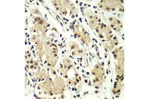 Immunohistochemistry of paraffin-embedded human gastric using ZNF264 antibody at dilution of 1:100 (x400 lens).