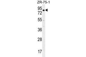 BRTC1 Antibody (N-term) western blot analysis in ZR-75-1 cell line lysates (35µg/lane). (BTRC Antikörper  (N-Term))