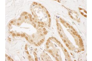 anti-TP53 induced glycolysis regulatory phosphatase (TIGAR) (AA 220-270) antibody