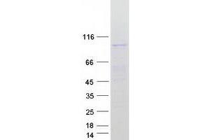 Western Blotting (WB) image for Testis Expressed 11 (TEX11) (Transcript Variant 2) protein (Myc-DYKDDDDK Tag) (ABIN2733445)