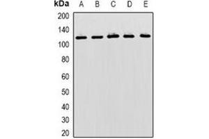 Western blot analysis of MBTPS1 expression in Hela (A), SKOV3 (B), mouse liver (C), mouse kidney (D), rat brain (E) whole cell lysates. (MBTPS1 Antikörper)