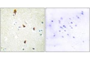 Immunohistochemistry (IHC) image for anti-Serotonin Receptor 2B (HTR2B) (AA 261-310) antibody (ABIN2889845) (Serotonin Receptor 2B Antikörper  (AA 261-310))