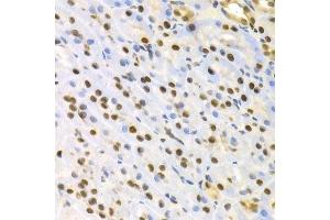 Immunohistochemistry of paraffin-embedded rat kidney using SFN Antibody. (14-3-3 sigma/SFN Antikörper  (AA 1-248))