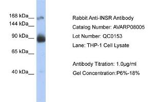 WB Suggested Anti-INSR  Antibody Titration: 0. (Insulin Receptor Antikörper  (Middle Region))