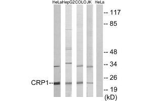 Western Blotting (WB) image for anti-Cysteine and Glycine-Rich Protein 1 (CSRP1) (Internal Region) antibody (ABIN1849240) (CSRP1 Antikörper  (Internal Region))
