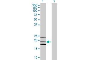 Western Blot analysis of PTGDS expression in transfected 293T cell line by PTGDS MaxPab polyclonal antibody. (PTGDS Antikörper  (AA 1-190))