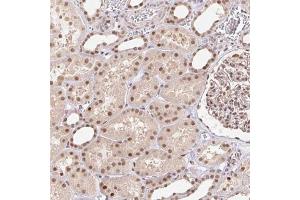 Immunohistochemical staining (Formalin-fixed paraffin-embedded sections) of human kidney with CAND1 polyclonal antibody  shows moderate cytoplasmic and nuclear positivity in renal tubules at 1:1000 - 1:2500 dilution.