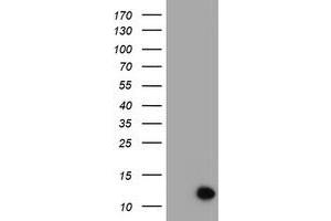 Image no. 1 for anti-Chromosome 17 Open Reading Frame 37 (C17orf37) antibody (ABIN1501775) (C17orf37 Antikörper)