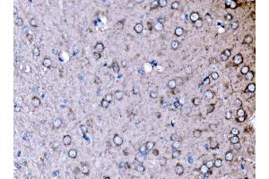 IHC analysis of PAK3 using anti-PAK3 antibody (ABIN7599182). (PAK3 Antikörper  (AA 1-263))