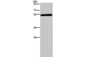 Western Blot analysis of Human breast infiltRative duct tissue using FOXC2 Polyclonal Antibody at dilution of 1:833 (FOXC2 Antikörper)