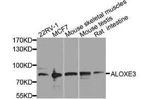 Western blot analysis of extracts of various cell lines, using ALOXE3 antibody. (ALOXE3 Antikörper  (AA 1-280))