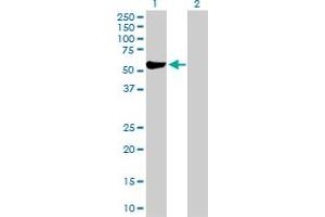Western Blot analysis of ALDH3A1 expression in transfected 293T cell line by ALDH3A1 MaxPab polyclonal antibody. (ALDH3A1 Antikörper  (AA 1-453))