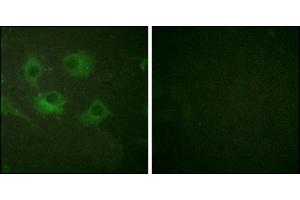 Immunofluorescence analysis of HuvEc cells, using Claudin 3 antibody. (Claudin 3 Antikörper)
