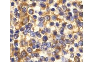 Immunohistochemistry of CCR3 in human spleen tissue with CCR3 antibody at 10 μg/ml. (CCR3 Antikörper  (C-Term))