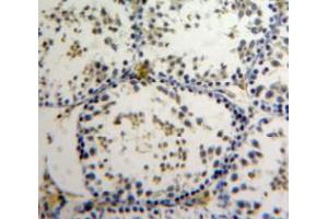 Used in DAB staining on fromalin fixed paraffin-embedded Testis tissue (AATF Antikörper  (AA 240-438))