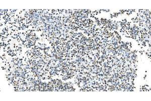 IHC analysis of DRP1/DNM1L using anti-DRP1/DNM1L antibody (ABIN7602180). (Dynamin 1-Like Antikörper  (AA 618-736))
