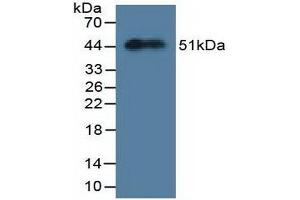 Figure. (MYL3/CMLC1 Antikörper  (AA 8-199))