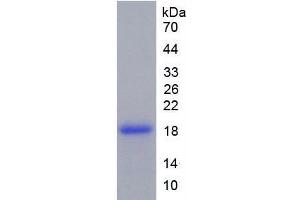 SDS-PAGE analysis of Rat Tenascin C Protein. (TNC Protein)