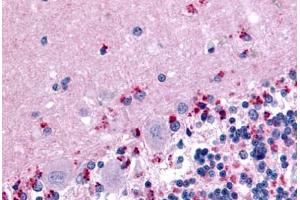 Immunohistochemistry (IHC) image for anti-Wingless-Type MMTV Integration Site Family, Member 2B (WNT2B) (N-Term) antibody (ABIN1049476)
