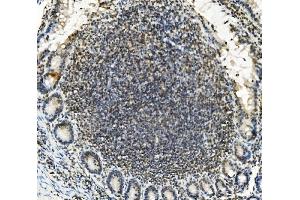 IHC analysis of LIN28A using anti-LIN28A antibody (ABIN7601176).