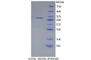 SDS-PAGE analysis of Human BST1 Protein. (BST1 Protein)