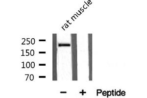 Western blot analysis on rat muscle tissue lysate using Sodium Channel-pan Antibody (Sodium Channel-Pan Antikörper)
