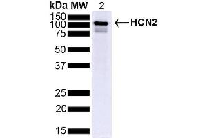 Western Blot analysis of Mouse Brain showing detection of ~95 kDa HCN2 protein using Mouse Anti-HCN2 Monoclonal Antibody, Clone S71 (ABIN361764). (HCN2 Antikörper  (AA 761-863))