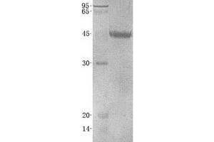 Western Blotting (WB) image for V-Set and Immunoglobulin Domain-Containing Protein 4 (VSIG4) (Transcript Variant 2) protein (His tag) (ABIN2735447)