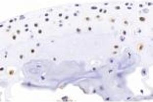 Immunohistochemistry analysis of paraffin-embedded mouse bone using BMP4 (ABIN7073215) at dilution of 1:2000. (BMP4 Antikörper)
