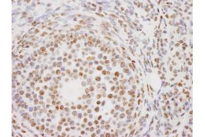 Immunohistochemistry (IHC) image for anti-Proline-, Glutamic Acid- and Leucine-Rich Protein 1 (PELP1) (AA 1000-1050) antibody (ABIN7448722) (PELP1 Antikörper  (AA 1000-1050))
