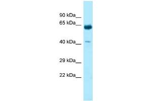 WB Suggested Anti-KRT9 Antibody Titration: 1. (KRT9 Antikörper  (C-Term))