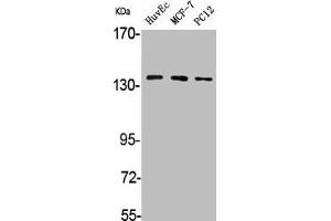 Western Blot analysis of HuvEc MCF7 PC12 cells using A Cyclase V/VI Polyclonal Antibody (ADCY6 Antikörper  (C-Term))