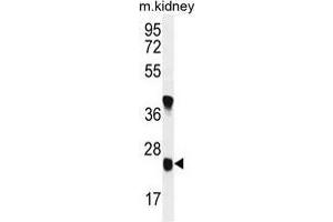 U119B Antibody (C-term) western blot analysis in mouse kidney tissue lysates (35 µg/lane). (UNC119B Antikörper  (C-Term))