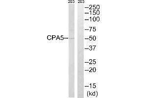 Western blot analysis of extracts from 293 cells, using CPA5 antibody. (CPA5 Antikörper)