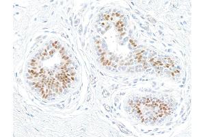 Immunohistochemistry (IHC) image for anti-Estrogen Receptor 1 (ESR1) antibody (ABIN7455134) (Estrogen Receptor alpha Antikörper)