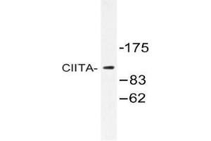 Western blot (WB) analysis of CIITA antibody in extracts from K562 cells.
