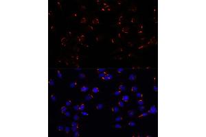 Immunofluorescence analysis of C6 cells using GOLG antibody (ABIN7267496) at dilution of 1:100. (GOLGA5 Antikörper  (AA 1-300))