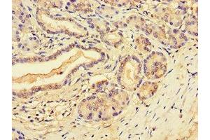 Immunohistochemistry of paraffin-embedded human pancreatic tissue using ABIN7168622 at dilution of 1:100 (SLFN11 Antikörper  (AA 670-821))