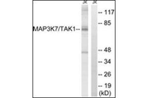 Western blot analysis of extracts from Jurkat cells, treated with heat shock, using MAP3K7 Antibody. (MAP3K7 Antikörper  (Internal Region))