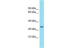 Host: Rabbit Target Name: FAM26E Sample Type: Fetal Lung lysates Antibody Dilution: 1. (FAM26E Antikörper  (Middle Region))