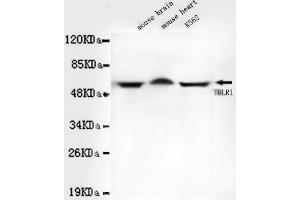 Western blot detection of TBLR1 in Mouse brain,Mouse heart and K562 cell lysates using TBLR1 mouse mAb (1:1000 diluted). (TBL1XR1 Antikörper)