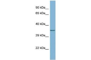 WB Suggested Anti-MEMO1 Antibody Titration: 0. (MEMO1 Antikörper  (Middle Region))