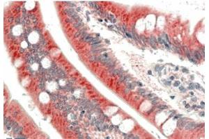AP31058PU-N C18orf8 antibody staining of paraffin embedded Human Small Intestine at 5 µg/ml. (C18orf8 Antikörper  (Internal Region))