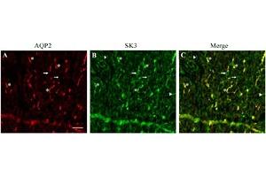Multiplex staining of SK3 and Aquaporin 2 in mouse kidneyImmunohistochemical staining of mouse kidney sections using Anti-KCNN3 (KCa2.