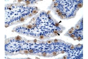 MCM6 antibody was used for immunohistochemistry at a concentration of 4-8 ug/ml to stain Epithelial cells of intestinal villus (lndicated with Arrows) in Human Intestine. (MCM6 Antikörper  (C-Term))