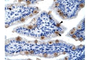 MCM6 antibody was used for immunohistochemistry at a concentration of 4-8 ug/ml to stain Epithelial cells of intestinal villus (lndicated with Arrows) in Human Intestine.